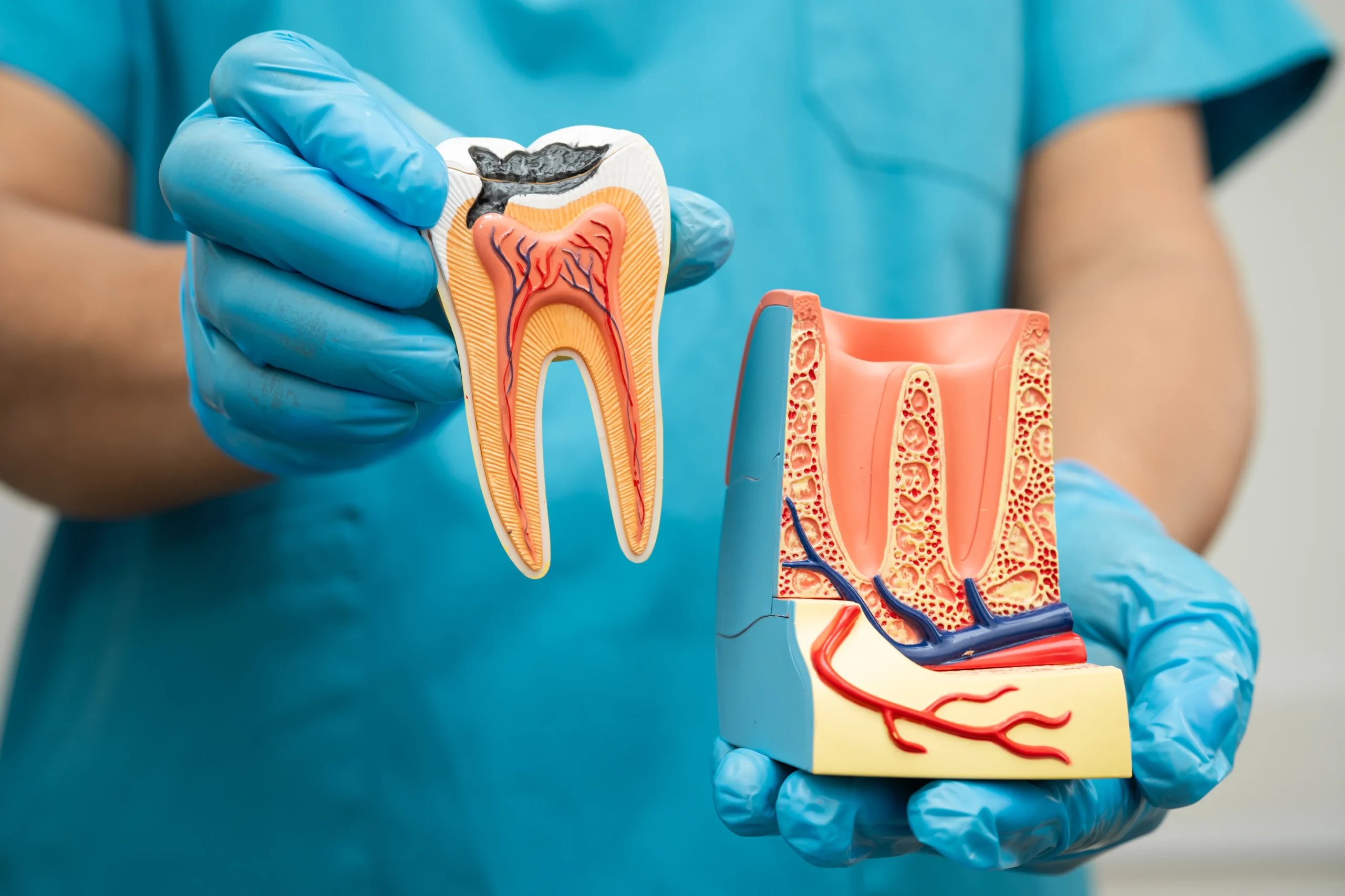 from plaque to decay graphic presentation