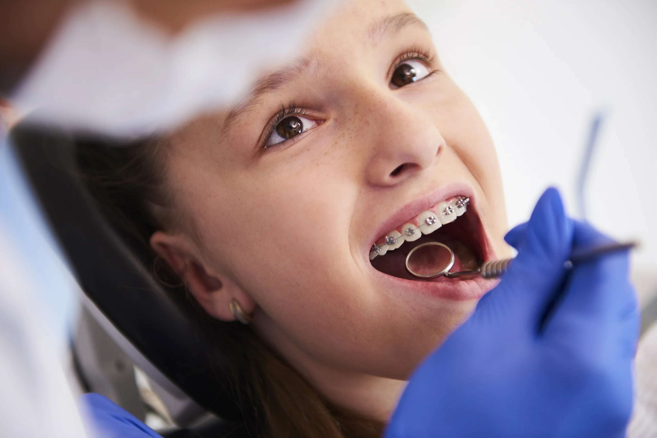 girl-with-braces-during-a-routine-dental-examination